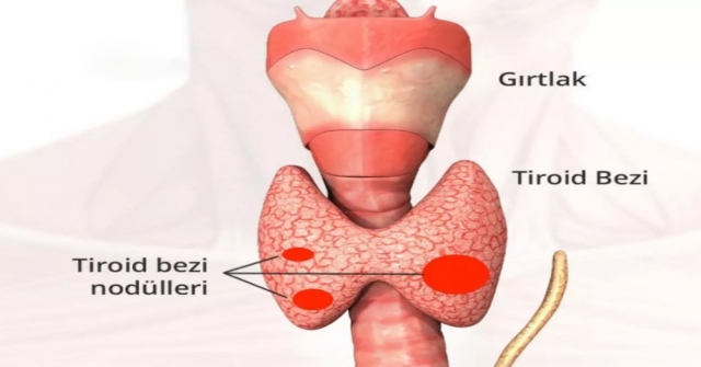 Hızlı Kilo Değişimi Tiroidden Olabilir