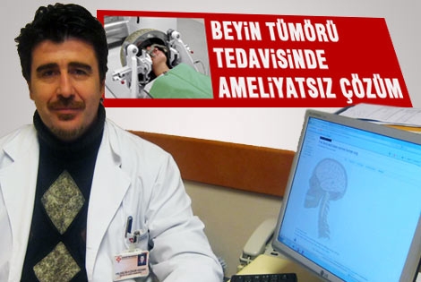 Beyin tümörü tedavisinde  ameliyatsız çözüm