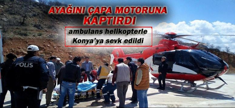 Ayağını Çapa Motoruna Kaptırdı