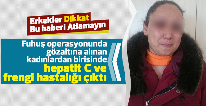 Fuhuş yapan kadında hepatit C ile frengi hastalığı çıktı