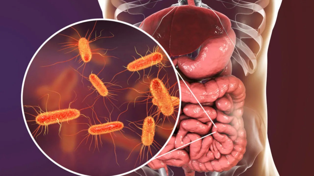 İngiltere'de Hızla Yayılan 'E. coli'  Salgınıyla İlgili UKHSA Uyarıyor